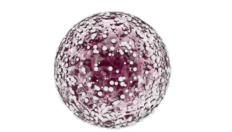 Skin cancer melanoma